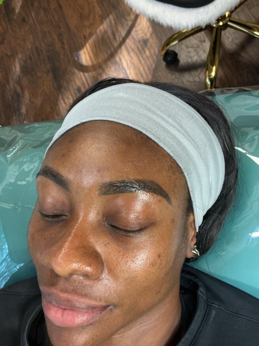 Eyebrow tattoo before removal on dark skin in Atlanta, GA